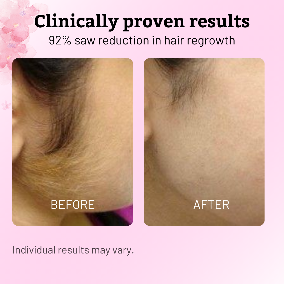 Cyperus Rotundus Oil - 60ml Natural Cyperus Rotundus Oil For Hair Removal, Moisturizing & Soothing Cyperus Oil For Reducing Body Hair Growth, Hair Removal Oil Ideal for All Skin Types